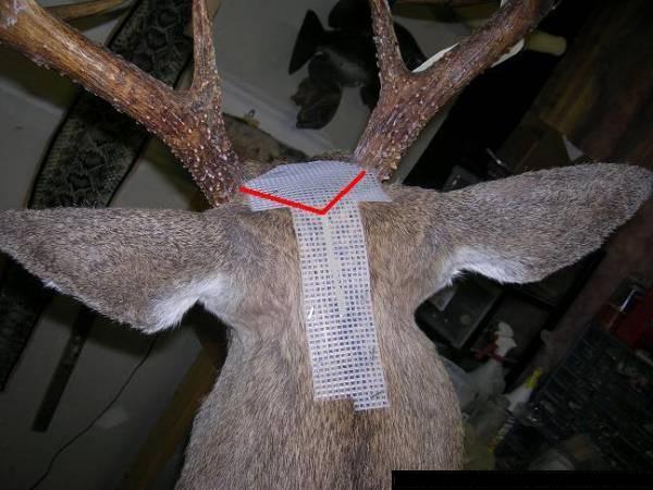 V incision