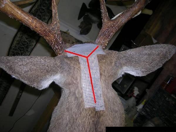 Y Incision